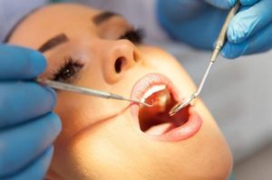 woman doing oral checkup